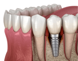 Deutsche Technik Dental Lab